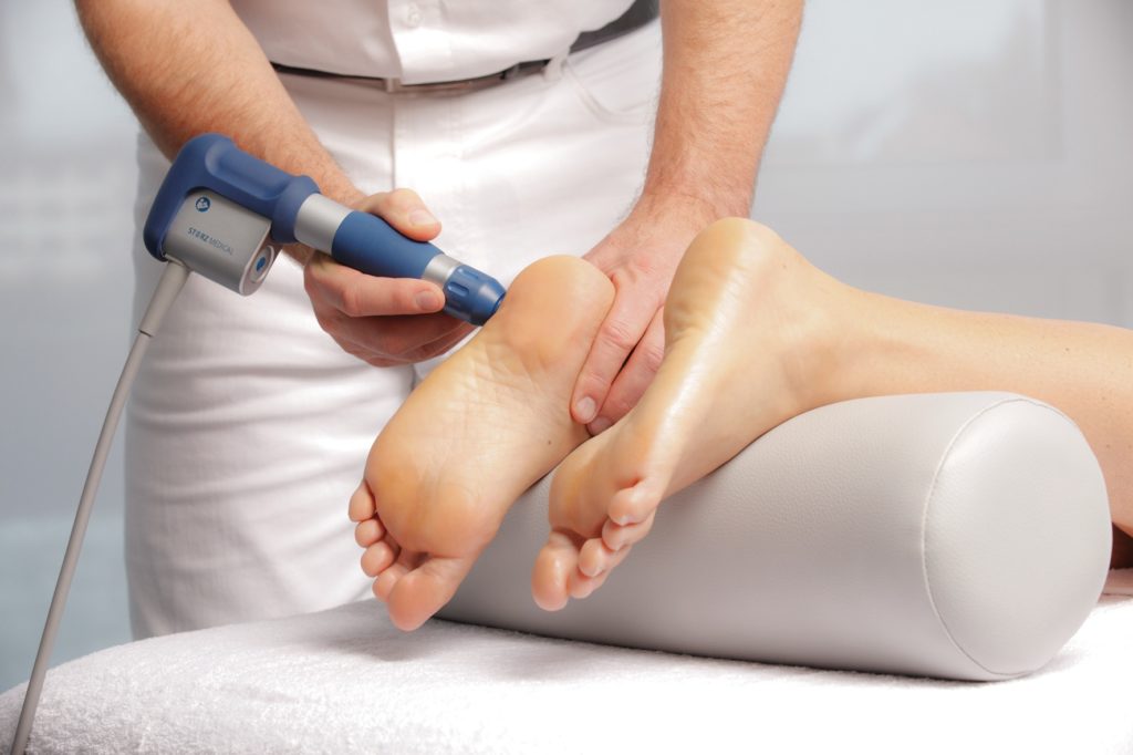 Plantar Fasciitis Shockwave with Storz Medical ESWT Plantar Fasciitis Shockwave with Storz Medical ESWT
