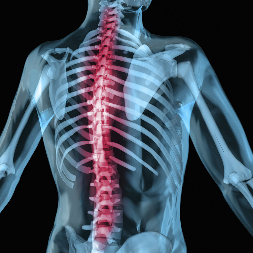 spine MRT Stafford