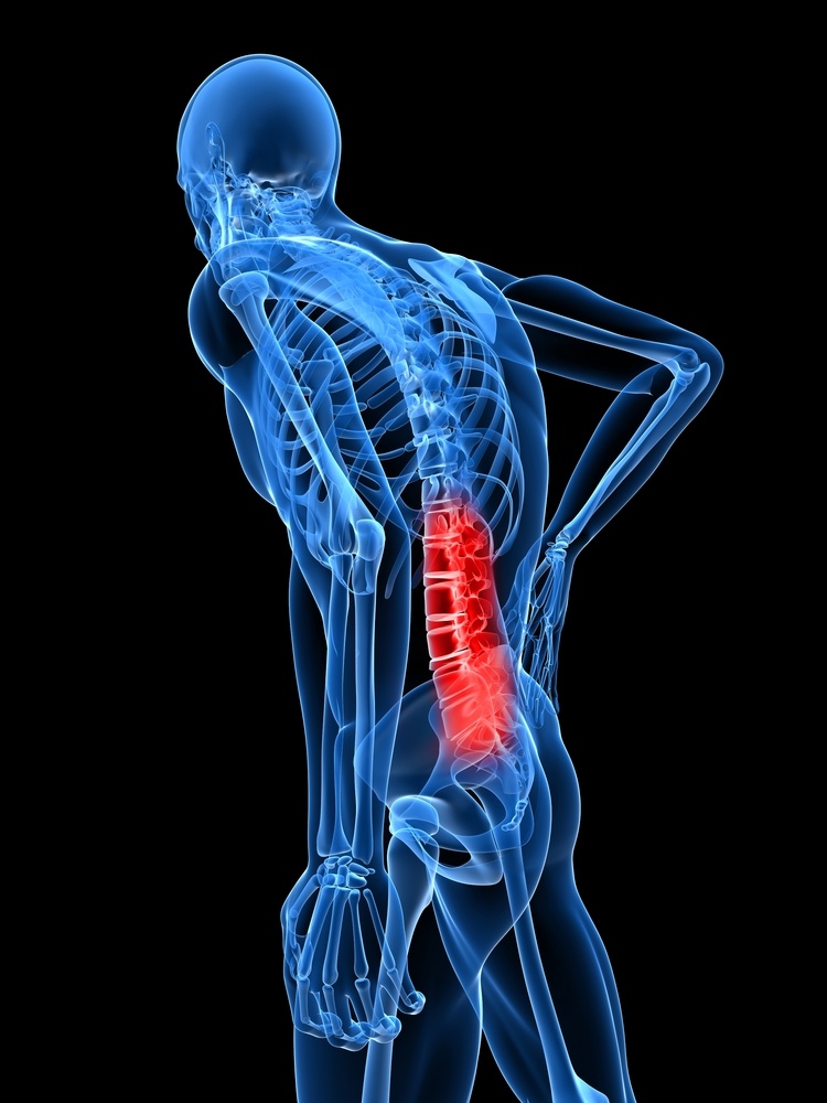 Back Pain Back Pain