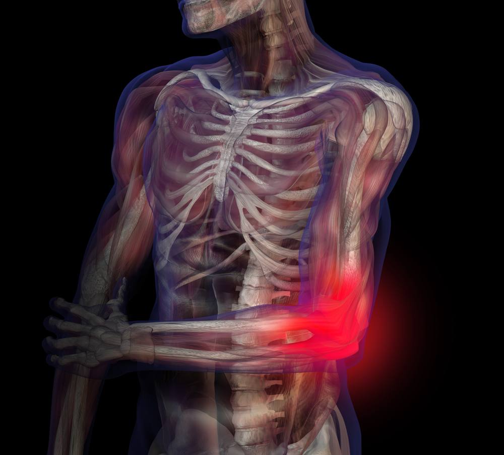 Elbow pain Elbow Pain