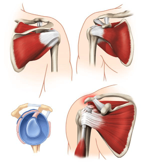 Rotator Cuff Physiotherapy image