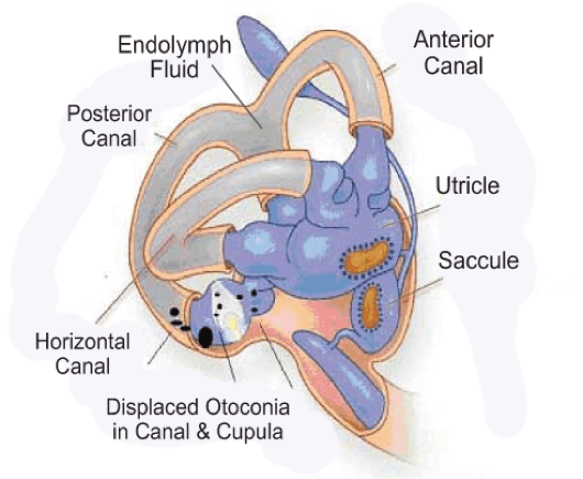 vertigo-inner-ear vertigo treatments, physiotherapists