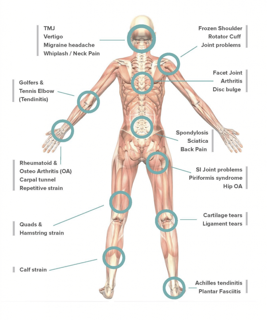 pain-relief-treatments