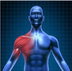 shoulder-inflamation shoulder-inflamation
