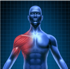 shoulder-inflamation