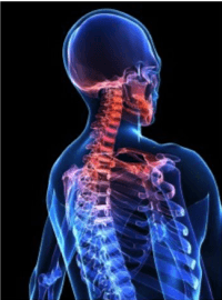 whiplash-image whiplash-treatments